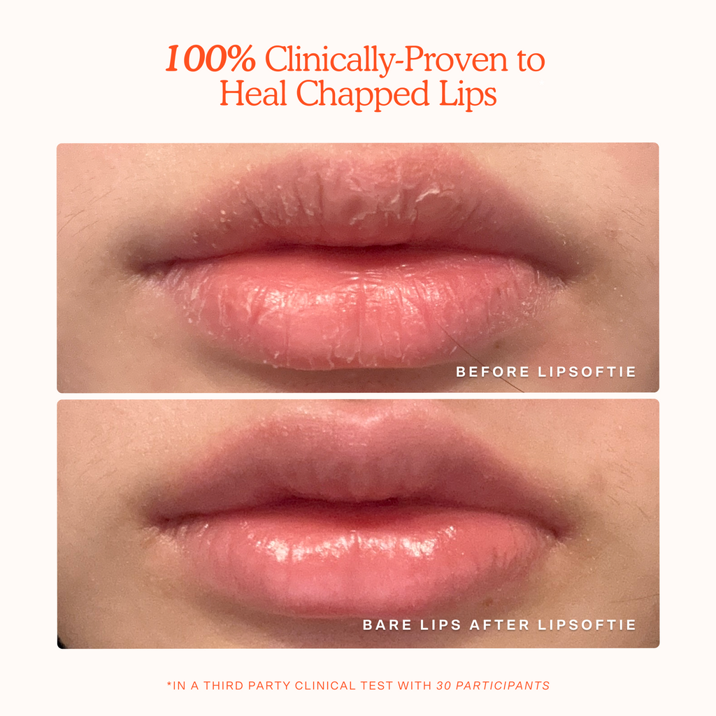 LipSoftie® Comfort lip treatment