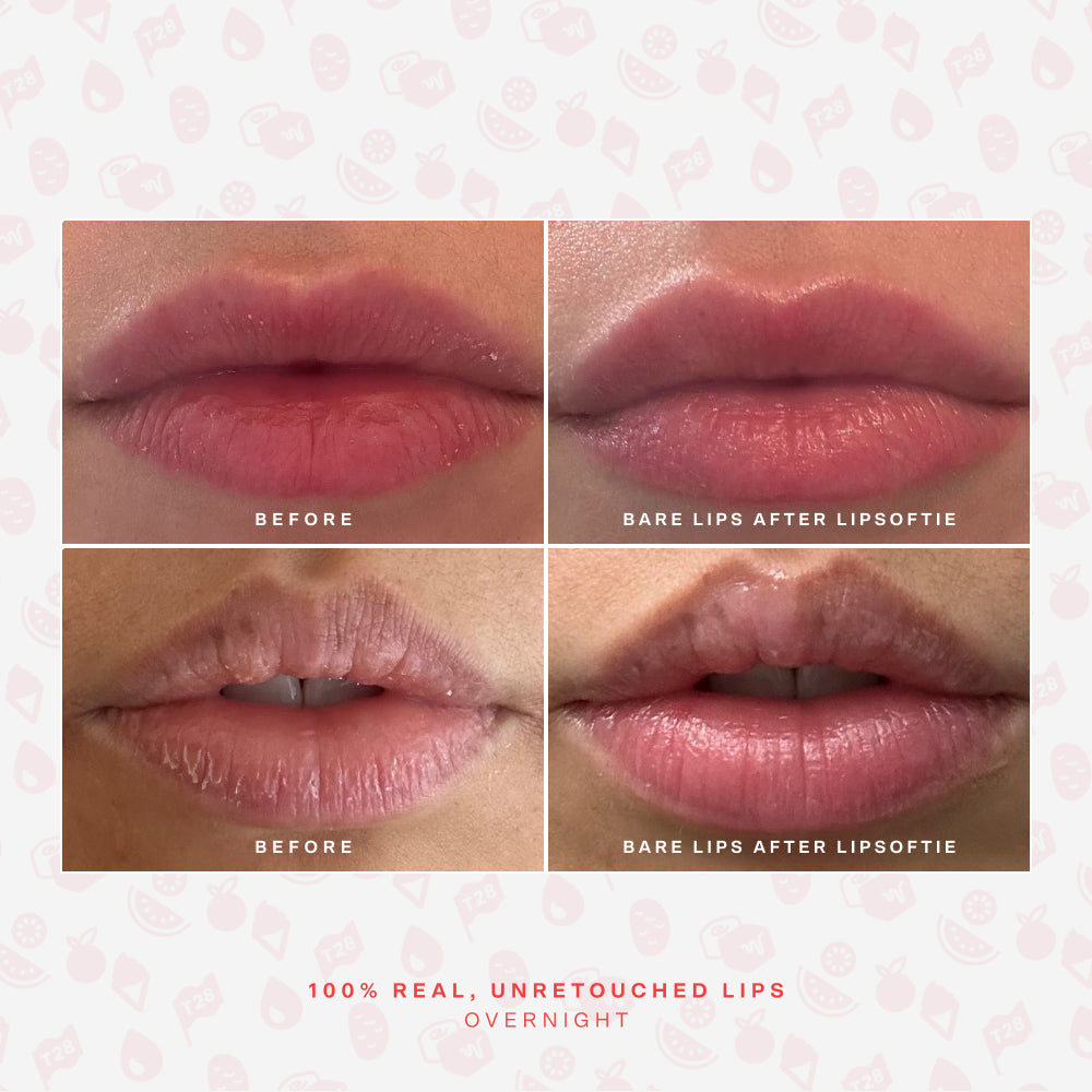 SOS LipSoftie® Comfort lip treatment