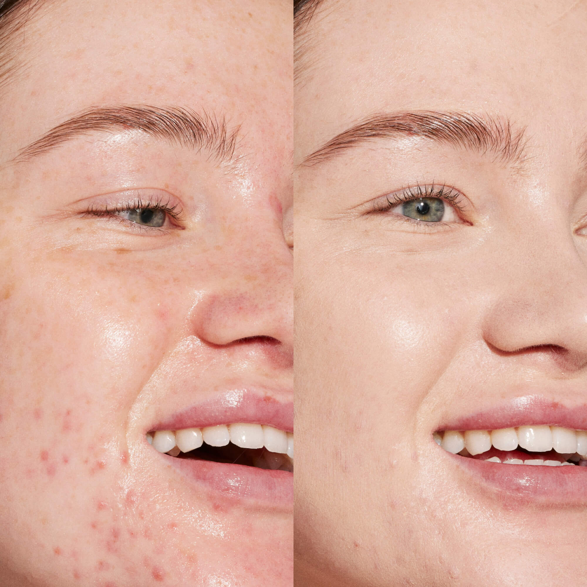 Swipe Smooth-Coverage serum concealer®